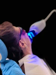 Teeth Whitening