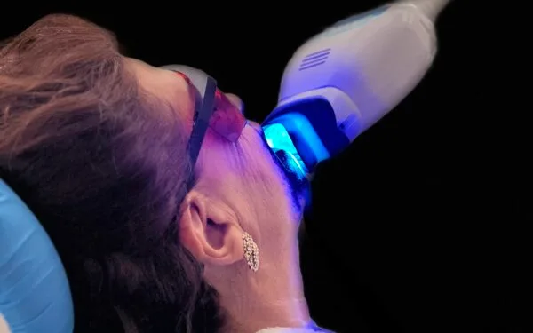 AuraDent Estetik Kliniğinde son teknoloji mavi ışık ile Diş Beyazlatma işlemi