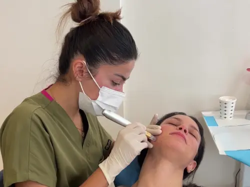 Mesotherapy / Youth Vaccine Injection to the face of our patient with Microneedling in AuraDent Aesthetic Clinic, Nicosia