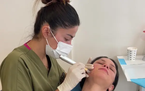 Mesotherapy / Youth Vaccine Injection to the face of our patient with Microneedling in AuraDent Aesthetic Clinic, Nicosia