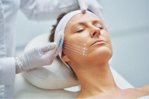 Doctor is handing thread lifting applicators in her hand and shows where the threads going to be inserted. Application in AuraDent feels Comfortable and flawless