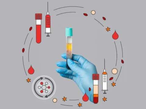 PRP treatment in AuraDent Aesthetic Clinic, Nicosia, Cyprus