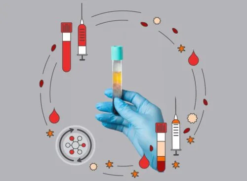 PRP treatment in AuraDent Aesthetic Clinic, Nicosia, Cyprus