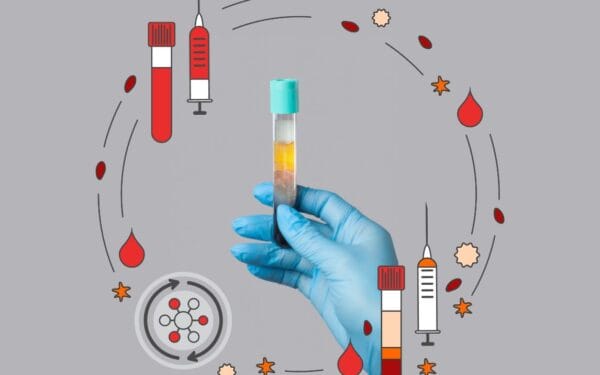 AuraDent Estetik Kliniği, Lefkoşa, Kıbrıs'ta PRP tedavisi