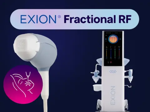 Exion Fraksiyonel Radyofrekans uygulaması ile ağrısız altın iğne uygulamamız artık kliniğimiz AuraDent, Lefkoşa'da