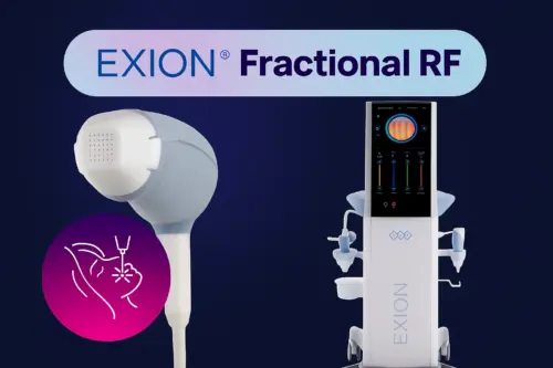 Our painless gold needle application with Exion Fractional Radiofrequency application is now in our clinic AuraDent, Nicosia
