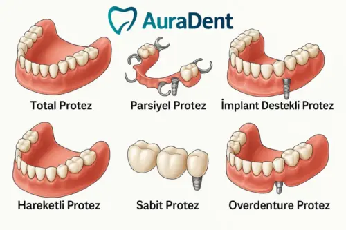 AuraDent Lefkoşa'da sunulan tüm protez çeşitleri: total protez, parsiyel protez, implant destekli protez, hareketli protez, sabit zirkonyum protez, immediat protez ve overdenture protez. Kıbrıs’ta estetik, fonksiyonel ve konforlu protez hizmetleri için AuraDent güvenilir çözümler sunar