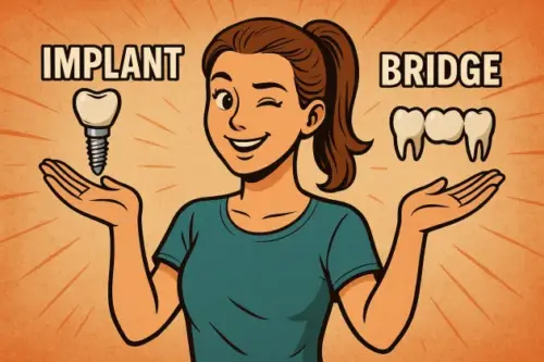 Should implant or bridge be preferred in tooth loss? Advantages, disadvantages and decision criteria - AuraDent Aesthetic Clinic Cyprus